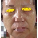 피코에피큐어 | 피코바이오 리프팅팩,화장품후기/미소지음화장품 팩후기/에이엔화장품 팩/AN화장품/에피큐어