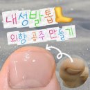 [위례 네일]10년 묵은 내성발톱 교정 후기🦶 문제성 발톱 전문 네일어베인 디에고푸스