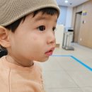 육아일기] 24개월 아기 온몸에 두드러기 올라온 원인, 후기 (알러지 테스트 결과 음성) + 추가글(피부과...