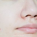 카멜리아의원 네이버블로그