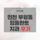 인천 부평역 근처 임플란트 가격 종류 및 후기 총정리 51곳