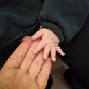 서울삼성이비인후과 건식 | 신생아 편측성 난청 진료 및 치료 후기 - 서울삼성, 서울대본원, 분당서울대
