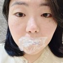 부산 센텀 피부과 입술필러 컴플렉스 극복 후기