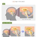 키아리