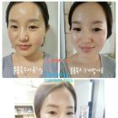 볼륨톡스 이미지