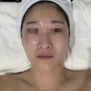 수성구 피부관리 대구 디자인라인스튜디오 윤곽관리 신부관리 추천