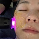 광선메디칼 | 성수동피부과 메디컬 에스테틱 피부관리 물광피부 만들어주는 제네오엑스 후기