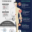 내 몸을 공격하는 자가면역질환 이미지