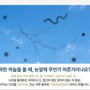 푸른하늘안과의원 | 눈앞의 '날파리'와 이별하는 법: 비문증에 관한 5가지 사실