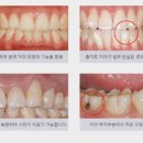 연세고운미소치과의원 이미지