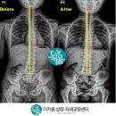 창원더키움병원 | 창원/마산/김해 평발,척추측만증 치료는 역시 창원더키움병원 성장자세교정센터!!