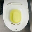 혜민한의원 | 혹시 혈변을 보시나요? 가려움증은요? 결과치가 좋은 혜민한의원 좌욕제 후기🤗