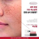 버닝헤드 이미지