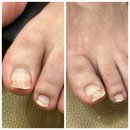 메디컬 스퀘어 | [부산 광안리] 문제성 손, 발톱 전문 “푸스케어 부산광안리w스퀘어점”