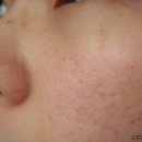 디카플러스 이미지