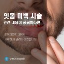 쌍문역 치과 강북다인치과에서 알려드리는 잇몸 미백 치료 대상 이미지