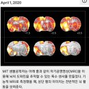 자료/뇌연구와 MRI 이미지