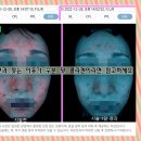 오창사랑의원 | 오창피부과 찾는 이유가 수분 및 콜라겐이라면 참고하세요