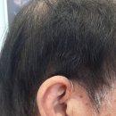 [남양주 보청기] 부모님 귀 건강 책임지는 시그니아 독일보청기 남양주센터 후기!