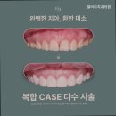 서울갤러리치과의원 이미지