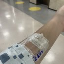 진해산소, 일사가스 | 따끈따끈한 담낭제거 수술 후기 I 응급입원 응급수술 담낭염 담석증 복강경수술 (2)