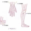 월오사암침, 항문출혈, 장출혈 치료 이미지