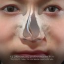 뉴진성형외과 이미지