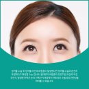신세계성형외과의원 이미지
