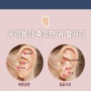 이혈 테라피 이미지
