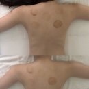 나비에스테틱 - 김해시 | 강남에스테틱 나비효과에스테틱 강남본점 림프맞춤관리 후기