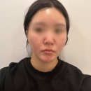 지오필러 이미지