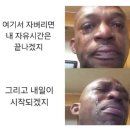글랜드헤어(gland hair) | 진짜 싸게 받은 여자 브라질리언 레이저 5회차 젠틀맥스프로플러스 | 후기 낋여왔습니다..^_^