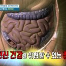 면역의 힘! 장이 형통해야 만사형통 이미지