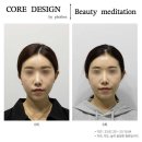 포이보스 이미지