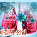 결핵 초기증상 원인 격리 폐결핵 전염 위험성 이미지