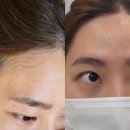 계양농업협동조합 | [계양] 미뷰티 :: 박촌동 페이스왁싱 대만족 후기