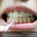 임플라인치과 이미지