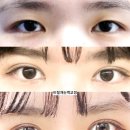 이루다성형외과의원 네이버블로그