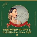 김*학 - 안양시 만안구 박달로 344 | 수원영어회화학원 투비단 어학원 김*학 님 후기 Before > After 음성파일