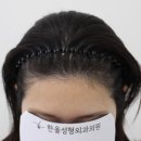 한올성형외과의원 이미지