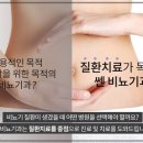쎈비뇨기과 이미지