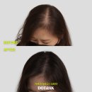 도트락강남 | 서울 강남구 신사동 탈모관리 도트락 본점 위치 가격 후기