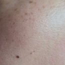 라움성형외과의원 이미지