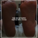 레푸스(REFUSS)&비욘드네일 | 반포네일 네일리코 레푸스 반포점 :: 여름 대비 발각질케어