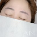 하이뷰티의원 이미지