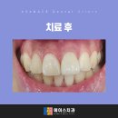 아산치과기공소 이미지