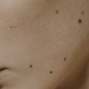 모래내피부과의원 이미지