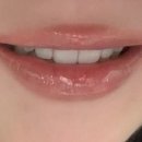 씨앤디자인치과기공소 | [내돈내산] 오브치과 오브제로 라미네이트 후기