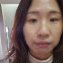 아티클크리닉 | 대구동구 미용실추천 | 화미주아티클헤어 이시아폴리스점| 에서 클리닉 받은 후기