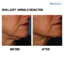 엘리트메디 이미지